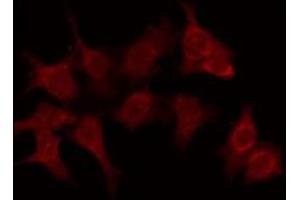 ABIN6276100 staining Hela by IF/ICC. (OR6C70 抗体  (C-Term))