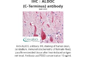 Image no. 1 for anti-Aldolase C, Fructose-Bisphosphate (ALDOC) (C-Term) antibody (ABIN2852410) (ALDOC 抗体  (C-Term))