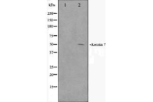 Western blot analysis on HepG2 cell lysate using Keratin 7 Antibody (Cytokeratin 7 抗体  (C-Term))