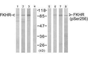 Western blot analysis using FKHR (Ab-256) antibody (E021138, Lane 1, 2, 3 and 4) and FKHR (phospho- Ser256)antibody (E011115, Lane 5, 6, 7 and 8). (FOXO1 抗体  (pSer256))