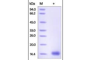 Human Cystatin D, His Tag on SDS-PAGE under reducing (R) condition.