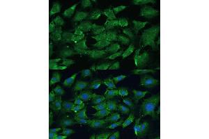 Immunofluorescence (IF) image for anti-Protein tyrosine Phosphatase, Non-Receptor Type 11 (PTPN11) (AA 1-460) antibody (ABIN6146440)