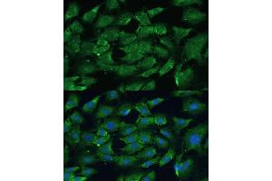 Immunofluorescence analysis of C6 cells using SHP2 antibody (ABIN6131893, ABIN6146440, ABIN6146441 and ABIN7101402) at dilution of 1:100. (PTPN11 抗体  (AA 1-460))