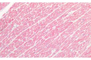 Immunohistochemistry (IHC) image for anti-Myosin Heavy Chain 1, Skeletal Muscle, Adult (MYH1) (AA 585-794) antibody (ABIN7432532)
