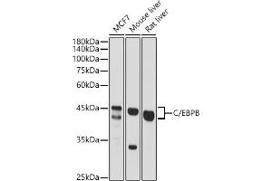 Western blot analysis of extracts of various cell lines, using C/EBPB antibody (ABIN6134025, ABIN6138382, ABIN6138383 and ABIN6213964) at 1:500 dilution. (CEBPB 抗体  (AA 150-250))