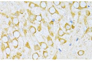 Immunohistochemistry of paraffin-embedded Rat brain using VARS Polyclonal Antibody at dilution of 1:100 (40x lens). (VARS 抗体)