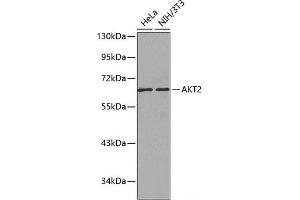Western blot analysis of extracts of various cell lines using AKT2 Polyclonal Antibody. (AKT2 抗体)