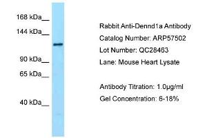Western Blotting (WB) image for anti-DENN/MADD Domain Containing 1A (DENND1A) (C-Term) antibody (ABIN2787247)