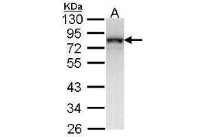 Western Blotting (WB) image for anti-NADH Dehydrogenase (Ubiquinone) Fe-S Protein 1, 75kDa (NADH-Coenzyme Q Reductase) (NDUFS1) (Center) antibody (ABIN2856931)