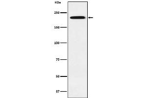 Western blot analysis of Gli3 expression in 293 cell lysate.