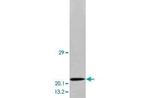 Western blot analysis of human brain tissue extracts with BDNF polyclonal antibody . (BDNF 抗体  (Middle Region))