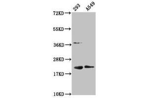 Western Blot Positive WB detected in: 293 whole cell lysate, A549 whole cell lysate All lanes: HIST1H1C antibody at 1:100 Secondary Goat polyclonal to rabbit IgG at 1/50000 dilution Predicted band size: 22 kDa Observed band size: 22 kDa (HIST1H1C 抗体  (meLys45))