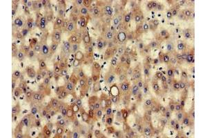 Immunohistochemistry of paraffin-embedded human liver tissue using ABIN7157444 at dilution of 1:100 (Cytokeratin 7 抗体  (AA 2-469))