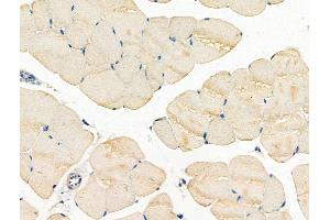 ABIN7093301 and ABIN7097320 at 1/100 staining Mouse muscle tissue by IHC-P.