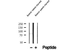 Western blot analysis of extracts of Ramos serum-starved, using Phospho-BTK(Tyr551) Antibody.