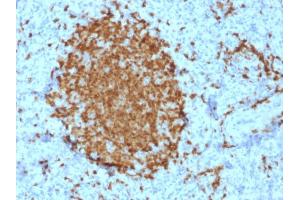 Immunohistochemistry (IHC) image for anti-POU Class 2 Associating Factor 1 (POU2AF1) (AA 148-255) antibody (ABIN6940353)