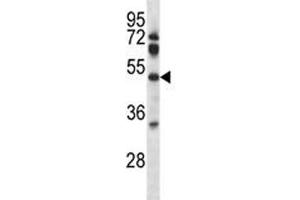 Pdk4 antibody western blot analysis in mouse lung tissue lysate.