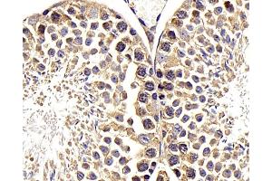 Immunohistochemistry analysis of paraffin-embedded mouse testis using RACGAP1 Polyclonal Antibody at dilution of 1:400. (RACGAP1 抗体)