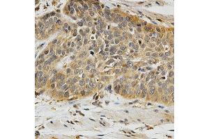 Immunohistochemistry (IHC) image for anti-Polo-Like Kinase 1 (PLK1) (AA 304-603) antibody (ABIN3023352) (PLK1 抗体  (AA 304-603))