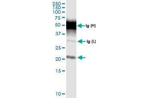 Immunoprecipitation of TMEM126B transfected lysate using anti-TMEM126B MaxPab rabbit polyclonal antibody and Protein A Magnetic Bead , and immunoblotted with TMEM126B MaxPab rabbit polyclonal antibody (D01) . (TMEM126B 抗体  (AA 1-200))