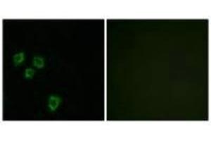 Immunofluorescence analysis of HepG2 cells, using MUC16 antibody. (MUC16 抗体)