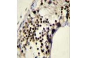 Immunohistochemistry (Paraffin-embedded Sections) (IHC (p)) image for anti-Rac GTPase Activating Protein 1 (RACGAP1) (AA 30-58), (N-Term) antibody (ABIN954428)