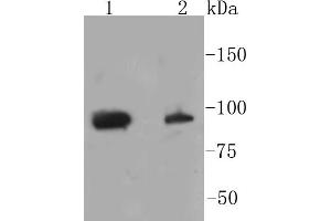 Western Blotting (WB) image for anti-Signal Transducer and Activator of Transcription 3 (Acute-Phase Response Factor) (STAT3) (pSer727) antibody (ABIN5557530)