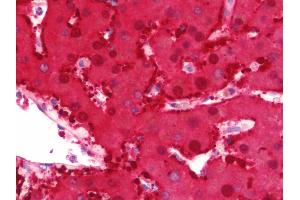 Anti-DDH / AKR1C1 antibody IHC staining of human liver. (AKR1C1 抗体  (AA 22-248))