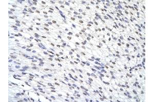 Rabbit Anti-ZFP36 antibody        Paraffin Embedded Tissue:  Human Heart cell   Cellular Data:  Epithelial cells of renal tubule  Antibody Concentration:   4.