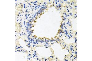 Immunohistochemistry of paraffin-embedded rat lung using CALU antibody at dilution of 1:100 (x40 lens). (CALU 抗体)