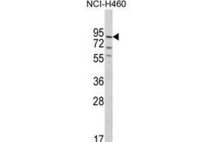 Western Blotting (WB) image for anti-Pleckstrin Homology Domain Containing, Family G (With RhoGef Domain) Member 6 (PLEKHG6) antibody (ABIN3002882)