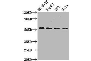 Western Blot Positive WB detected in: SH-SY5Y whole cell lysate, HepG2 whole cell lysate, 293 whole cell lysate, Hela whole cell lysate All lanes: SLC19A3 antibody at 3. (SLC19A3 抗体  (AA 191-282))