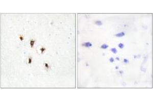 Immunohistochemistry analysis of paraffin-embedded human brain tissue, using Mevalonate Kinase Antibody. (MVK 抗体  (AA 151-200))