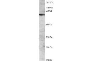 Western Blotting (WB) image for IL2-Inducible T-Cell Kinase (ITK) peptide (ABIN369790) (IL2-Inducible T-Cell Kinase (ITK) Peptide)