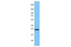 Western Blotting (WB) image for anti-BH3 Interacting Domain Death Agonist (BID) antibody (ABIN2666317) (BID 抗体)