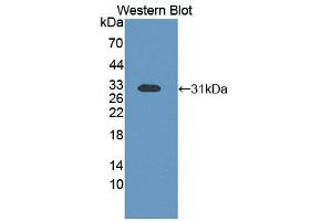 Western blot analysis of recombinant Human ETFb. (ETFB 抗体  (AA 2-255))