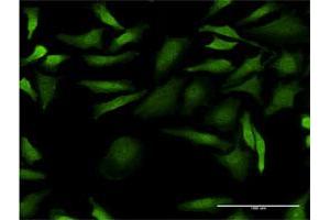 Immunofluorescence of monoclonal antibody to CDC2 on HeLa cell. (CDK1 抗体  (AA 211-297))