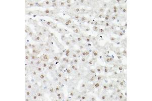 Immunohistochemistry of paraffin-embedded mouse liver using LEO1 Rabbit pAb (ABIN6133790, ABIN6143141 and ABIN7101832) at dilution of 1:100 (40x lens).