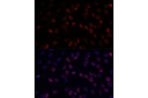 Immunofluorescence (IF) image for anti-DEAD (Asp-Glu-Ala-Asp) Box Polypeptide 24 (DDX24) (AA 510-859) antibody (ABIN7266691)
