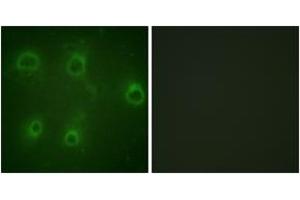 Immunofluorescence analysis of COS7 cells, using IL-8R beta/CDw128 beta (Phospho-Ser347) Antibody. (CXCR2 抗体  (pSer347))