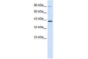 WB Suggested Anti-CCDC16 Antibody Titration:  1. (CCDC16 抗体  (Middle Region))