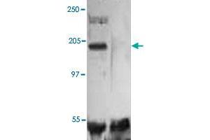 The whole cell lysate derived from human umbilical vein endothelial cell (HUVEC) was stimulated by VEGF-A for 20 min, then immunoprecipitated by KDR polyclonal antibody  followed by immune-probing with KDR polyclonal antibody  at 1 : 500. (VEGFR2/CD309 抗体  (Extracellular Domain))