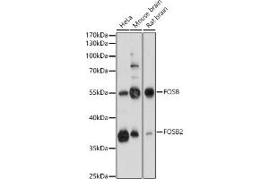 Western blot analysis of extracts of various cell lines, using FOSB antibody (ABIN7267159) at 1:1000 dilution. (FOSB 抗体  (AA 1-100))