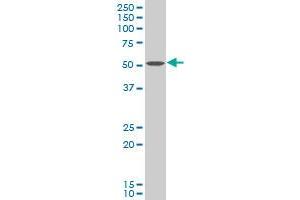 Choline Kinase alpha 抗体  (AA 294-393)