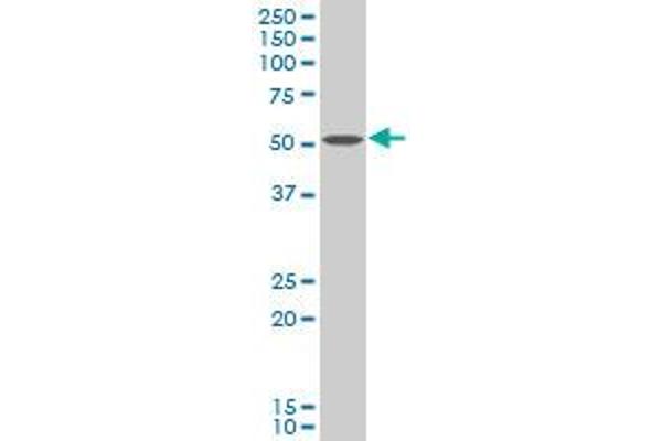 Choline Kinase alpha 抗体  (AA 294-393)