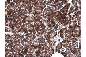 Image no. 3 for anti-Mitogen-Activated Protein Kinase Kinase 1 (MAP2K1) antibody (ABIN1499394) (MEK1 抗体)