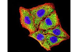 Immunocytochemistry (ICC) image for anti-BCL2/adenovirus E1B 19kDa Interacting Protein 3 (BNIP3) (AA 50-155) antibody (ABIN5858883) (BNIP3 抗体  (AA 50-155))