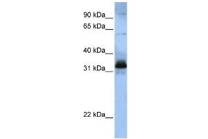 WB Suggested Anti-SFRS2B  Antibody Titration: 0. (SFRS2B 抗体  (Middle Region))