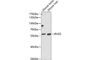 Western blot analysis of extracts of various cell lines using RAG2 Polyclonal Antibody at dilution of 1:1000. (RAG2 抗体)