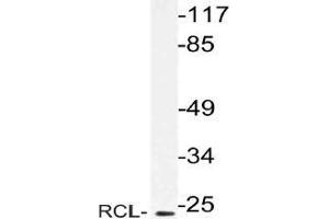 Western blot (WB) analysis of RCL antibody in extracts from Jurkat cells. (RCL 抗体)